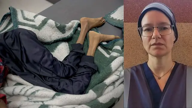 'Video thumbnail for 'Many Palestinians in Gaza are just skin and bone': Doctor'