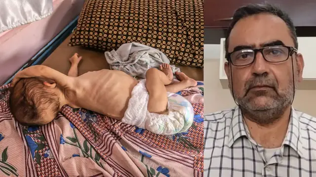 'Video thumbnail for Babies in Gaza face irreversible harm from starvation and lack of aid, doctors warn'