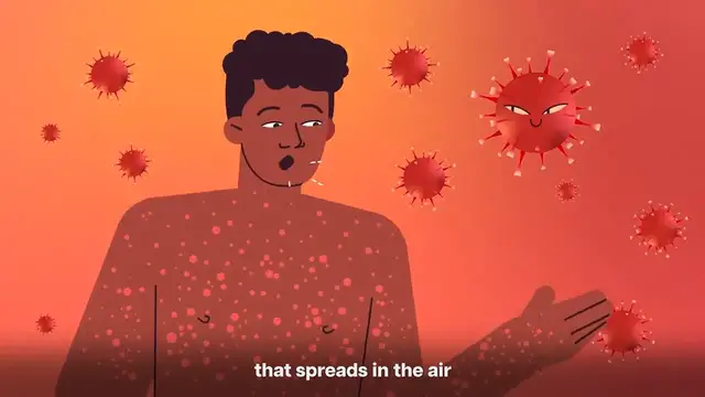 'Video thumbnail for Why Should You Get the Rubella Vaccine'