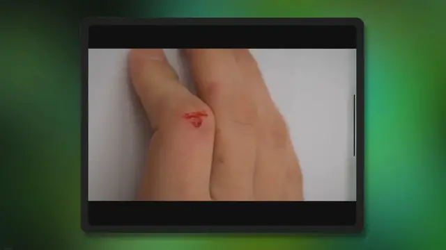 'Video thumbnail for Ácido Cítrico para la Piel: Exfoliación, Despigmentación y Más | Guía Completa'
