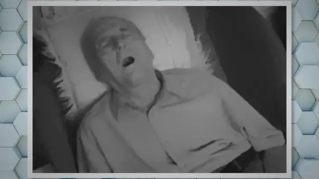 'Video thumbnail for Best Chin Strap for Mouth Breathers'